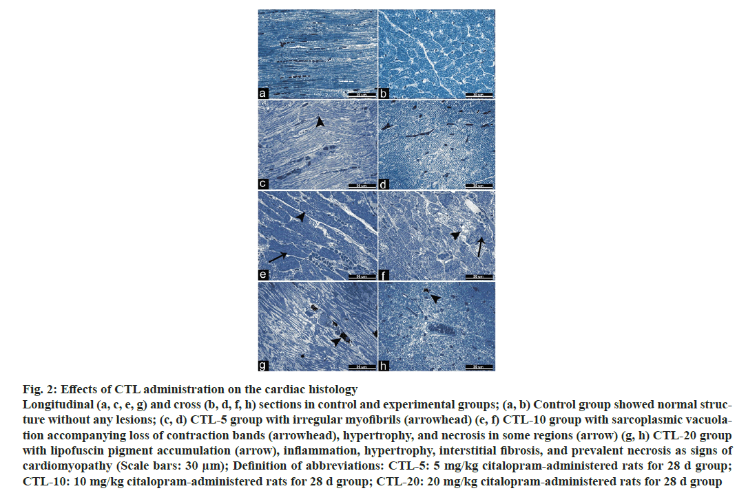 IJPS-myofibrils