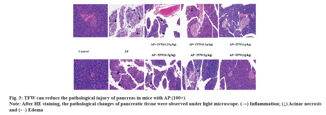 IJPS-pancreas