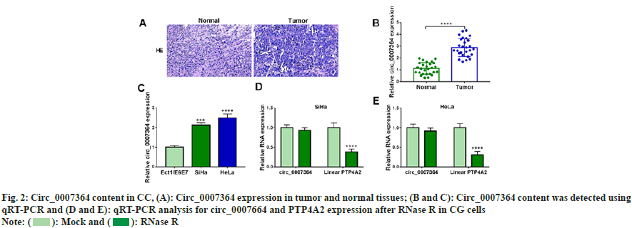 IJPS-tumor