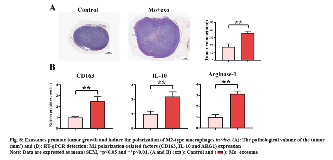 IJPS-tumor