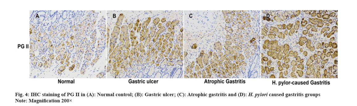 IJPS-ulcer