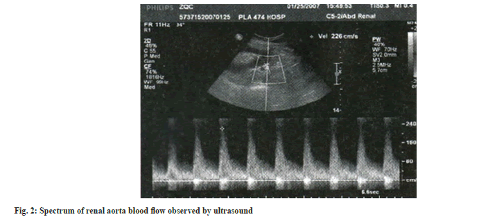 ultrasound