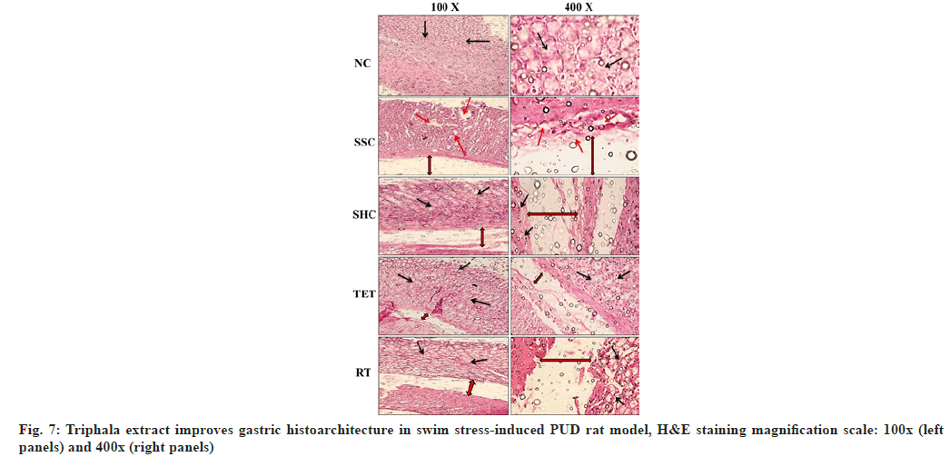 ijps-gastric