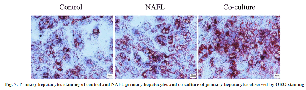 ijps-hepatocytes