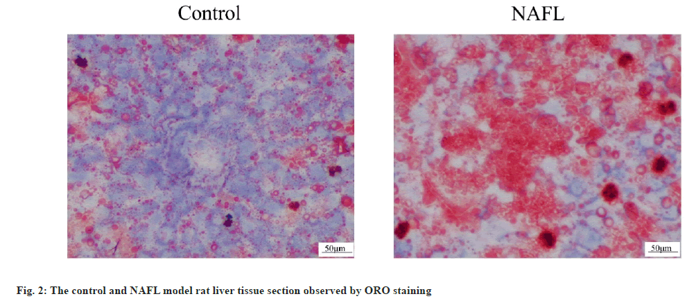 ijps-liver