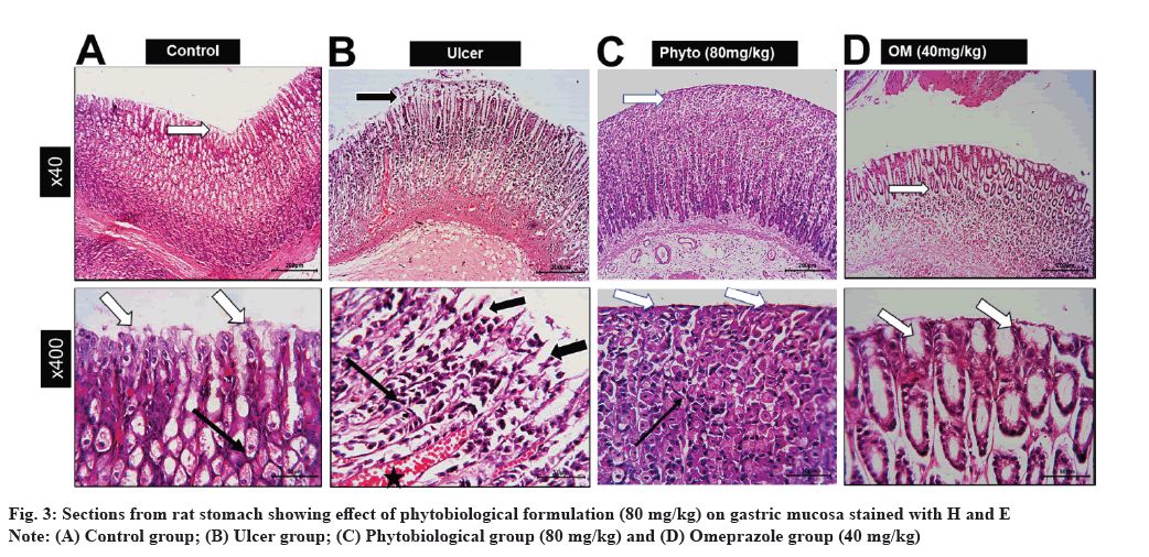 ijps-stomach