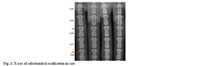 ijps-subchondral