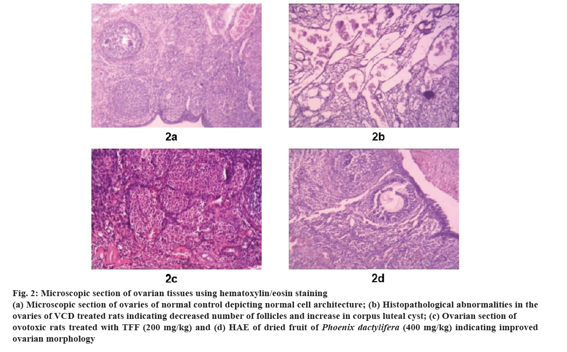 IJPS-86-1-ovarian