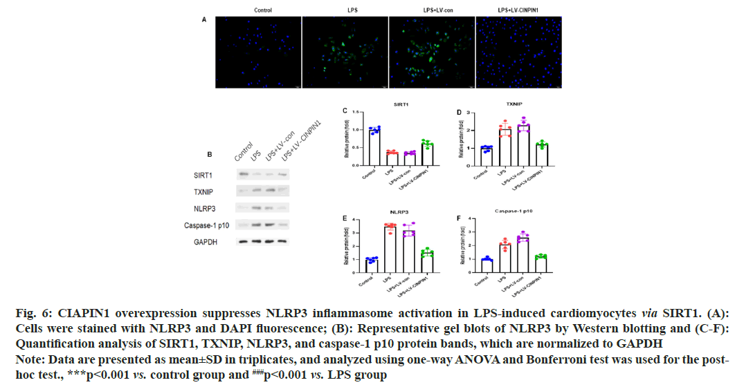 IJPS-Quantification