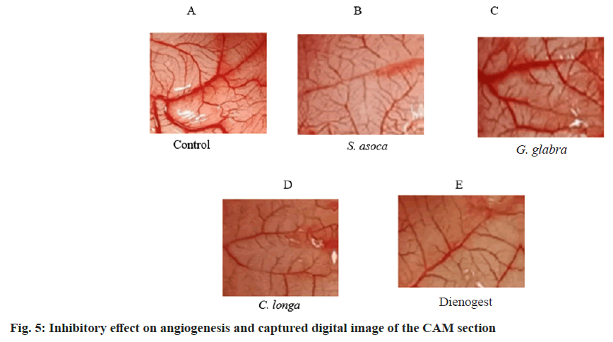 IJPS-angiogenesis