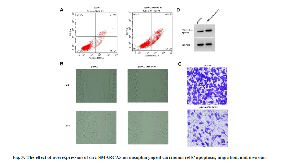 IJPS-carcinoma