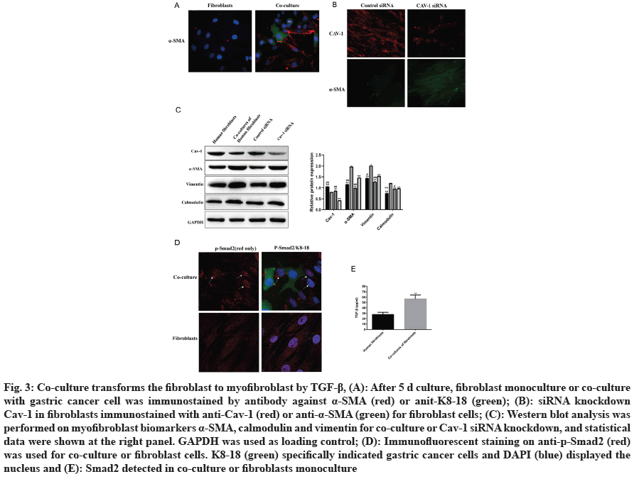 fibroblast
