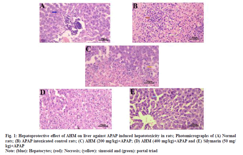 IJPS-hepatoprotective-effect