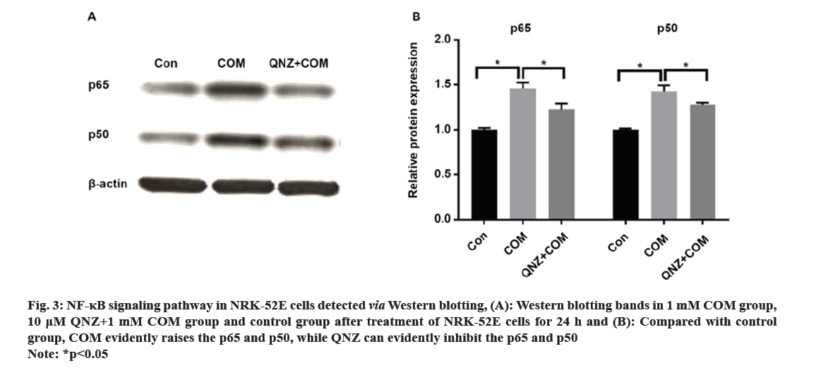 IJPS-inhibit