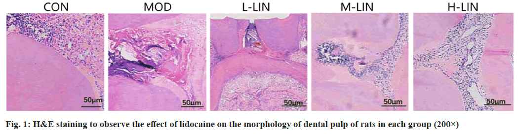 IJPS-lidocaine