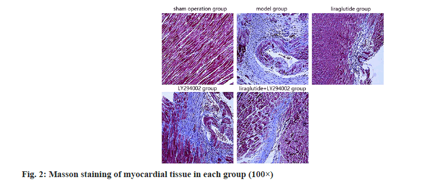 IJPS-masson-staining