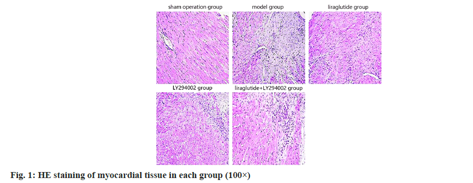 IJPS-myocardial-tissue