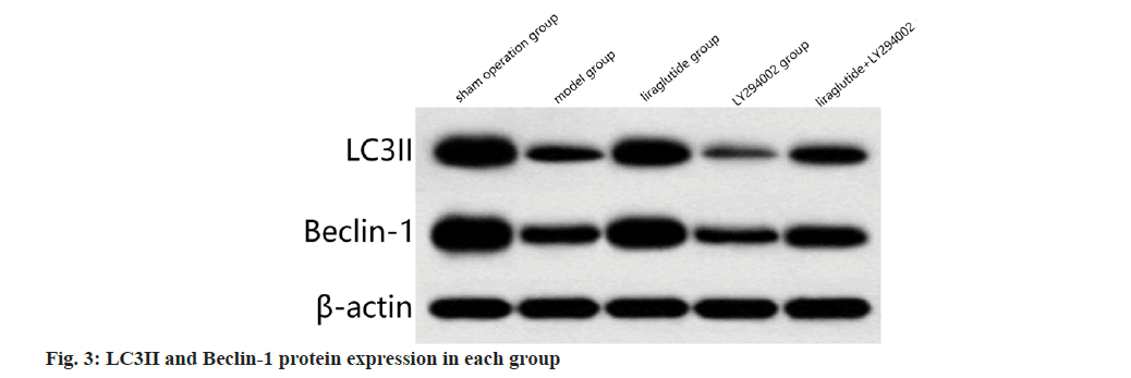 IJPS-protein-expression