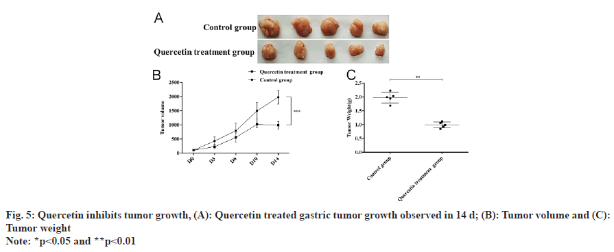 tumor