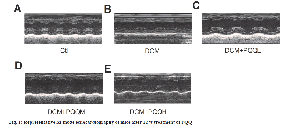 echocardiography