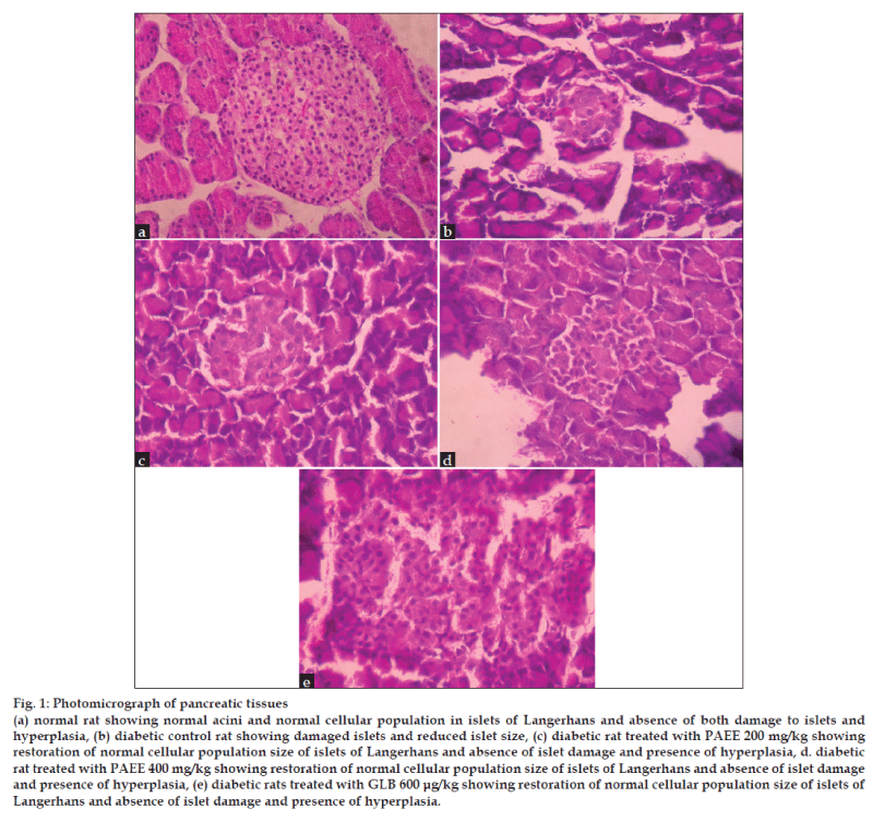 800px x 752px - Antihyperglycemic and Antihyperlipidemic Activity of Plectranthus  Amboinicus on Normal and Alloxan- Induced Diabetic Rats