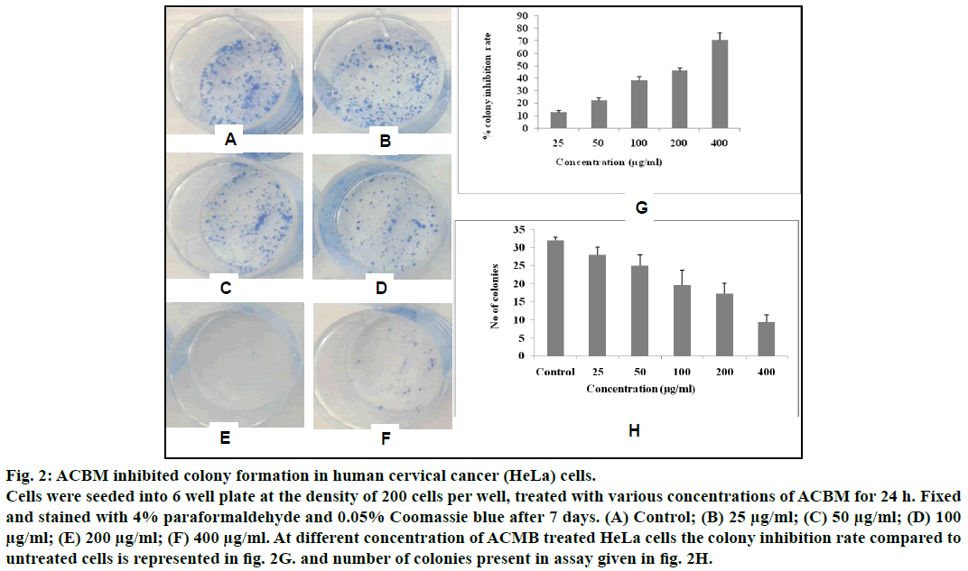 IJPS-ACBM-inhibited