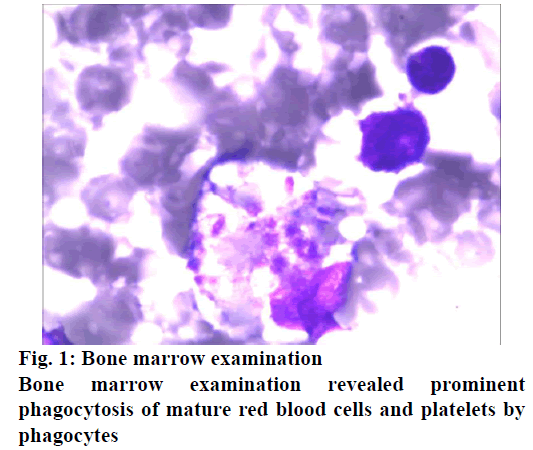 IJPS-Bone-marrow