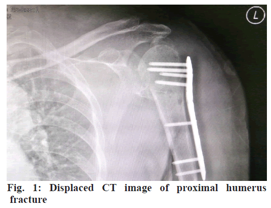 IJPS-CT-image