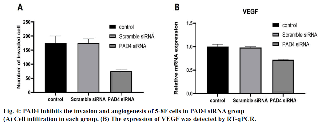 IJPS-Cell-infiltration