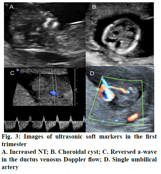 IJPS-Choroidal