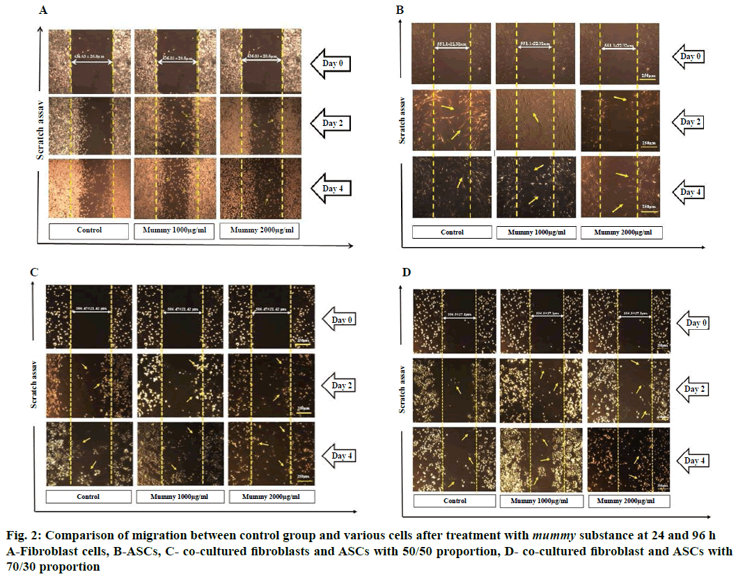 IJPS-Comparison-migration