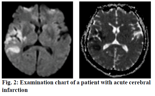 IJPS-Examination