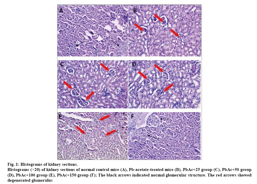 IJPS-Histograms-kidney-sections