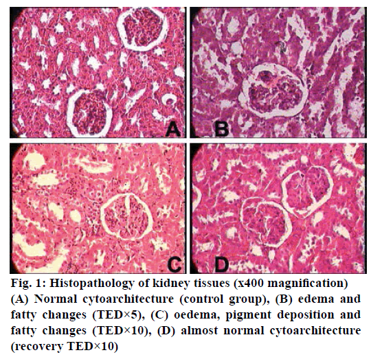 IJPS-Histopathology-kidney