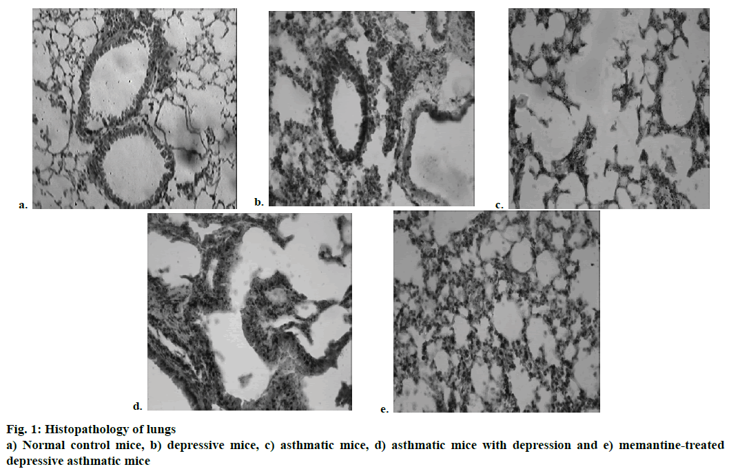 IJPS-Histopathology-lungs