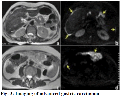 IJPS-Imaging