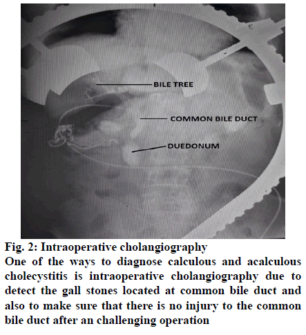 IJPS-Intraoperative-cholangiography
