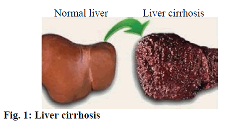 IJPS-Liver