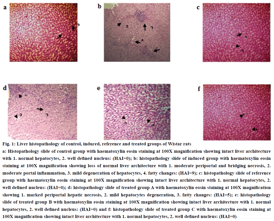 IJPS-Liver-histopathology