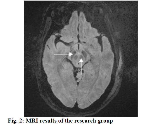 IJPS-MRI-results