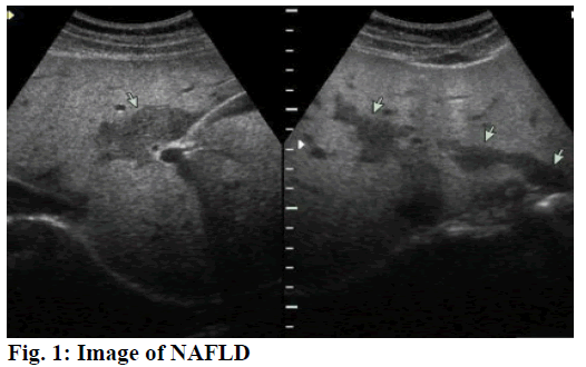 IJPS-NAFLD