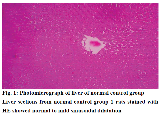 IJPS-Photomicrograph-liver