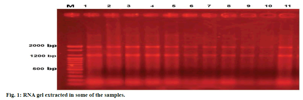 IJPS-RNA-gel-extracted