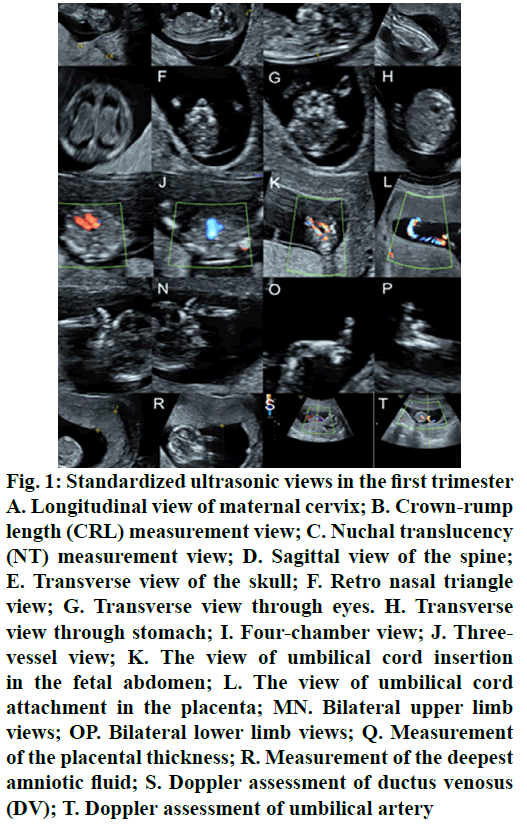 IJPS-Standardized