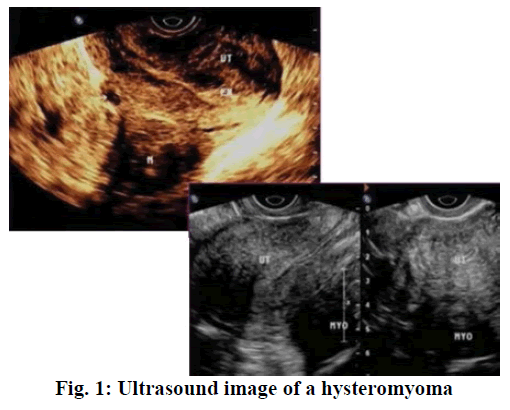 IJPS-Ultrasound
