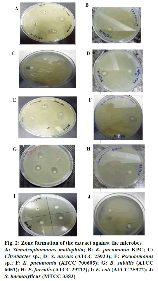 IJPS-Zone-formation