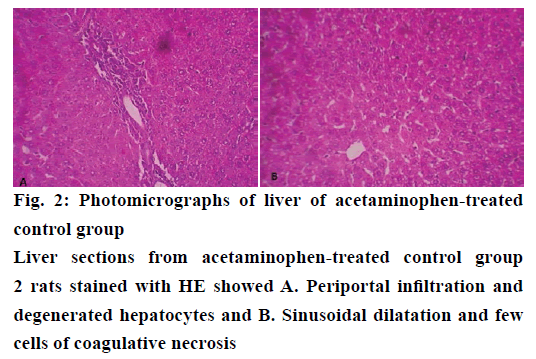 IJPS-acetaminophen-treated-control