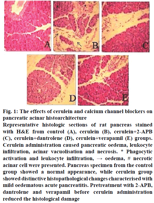 IJPS-calcium-channel-blockers