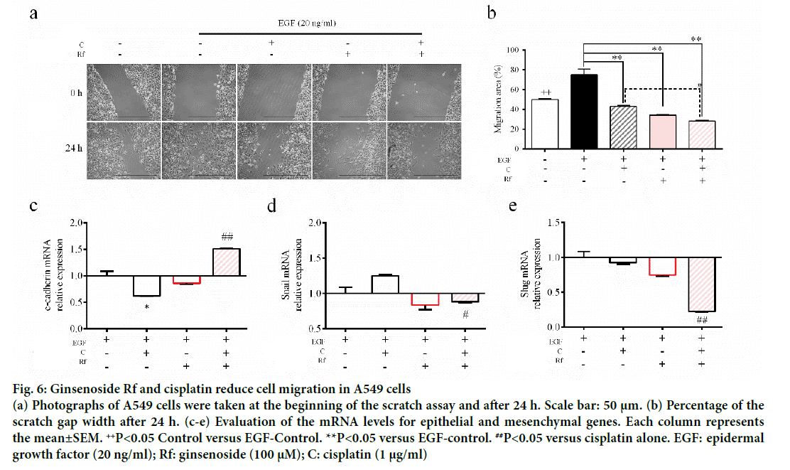 IJPS-cell-migration