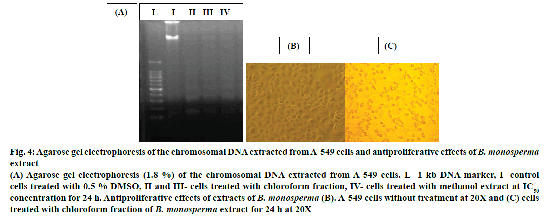 IJPS-chromosomal-DNA-extracted